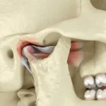 7 Hal yang Harus Kamu Tahu Tentang TMJ (Temporomandibular Joint)