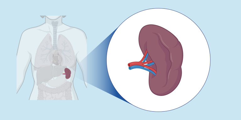 10 Hal yang Harus Diperhatikan Jika Kamu Hidup Tanpa Limpa