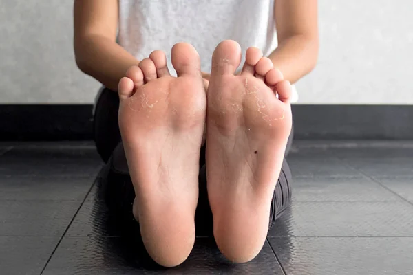 5 Cara Menjaga Postur Kaki agar Tidak Mudah Lelah