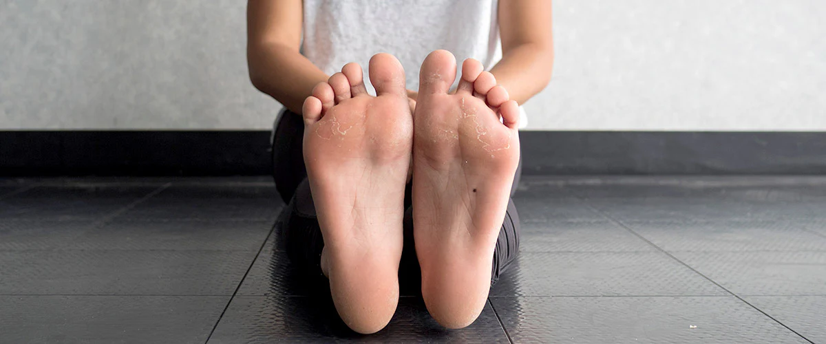 5 Cara Menjaga Postur Kaki agar Tidak Mudah Lelah