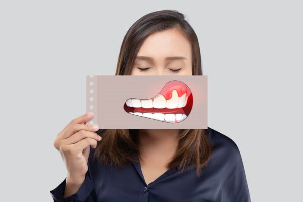 7 Cara Menjaga Kesehatan Gusi Saat Sedang Sakit 7 Cara Menjaga Kesehatan Gusi Saat Sedang Sakit