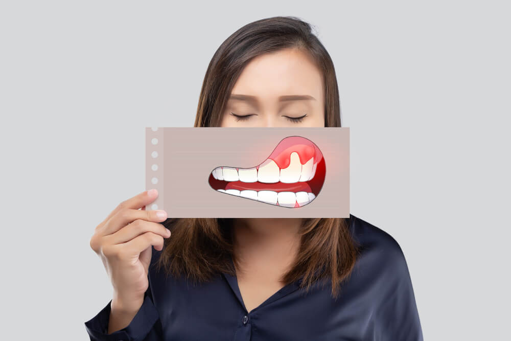 7 Cara Menjaga Kesehatan Gusi Saat Sedang Sakit